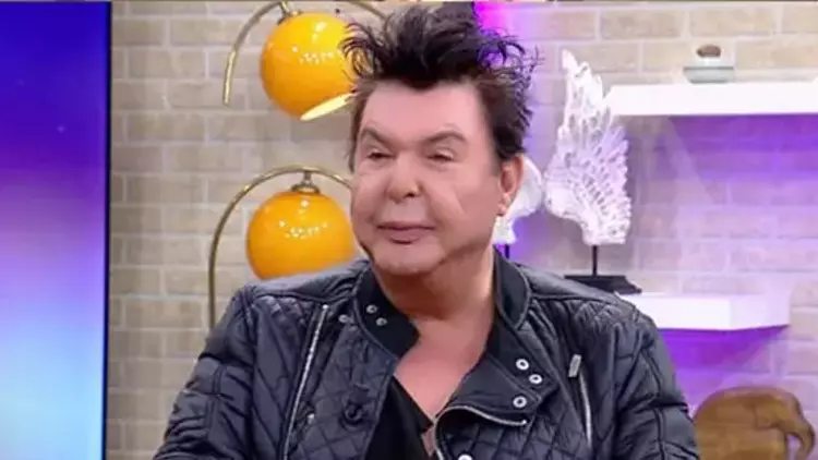 Kuşum Aydın yeni bir estetik operasyon geçirdi!!