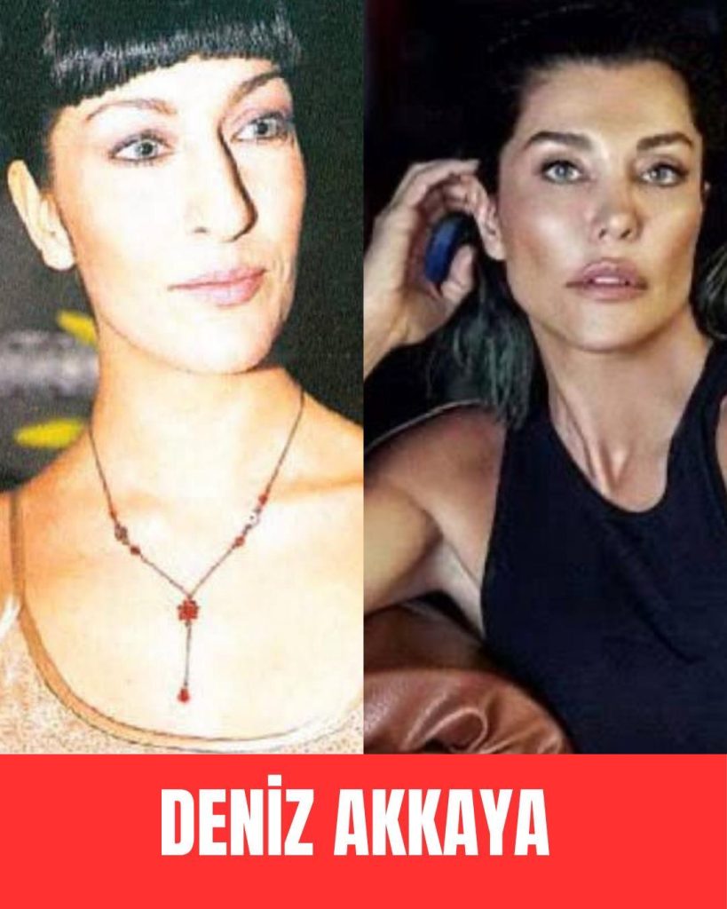 Deniz Akkaya yeni